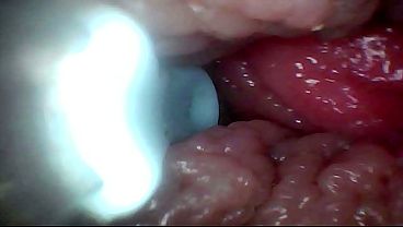 Extreme Proximity Turns Watcher Into Active, Hungry Participant